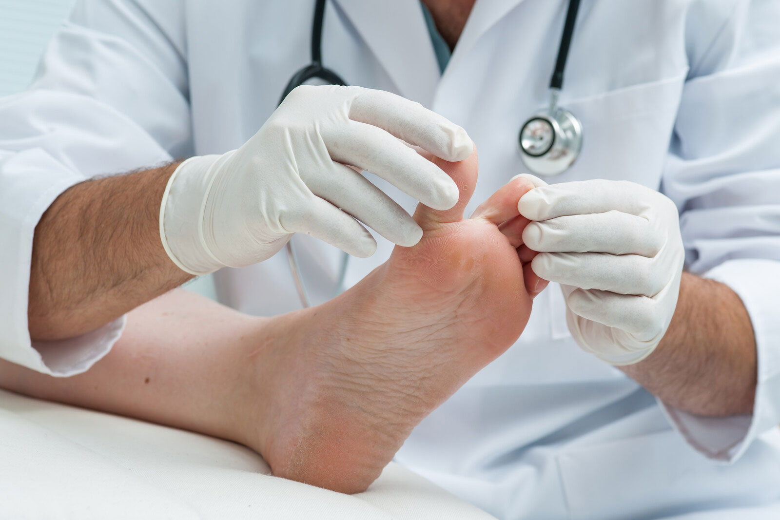 Five Common Foot Problems and Their ICD-10 Codes